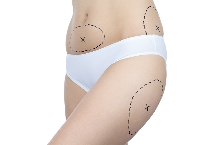 huiles essentielles cellulite